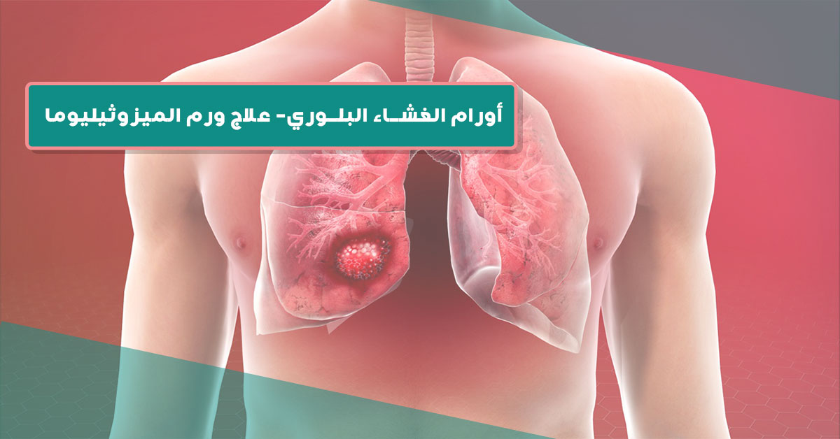 أورام الغشاء البلوري- علاج ورم الميزوثيليوما