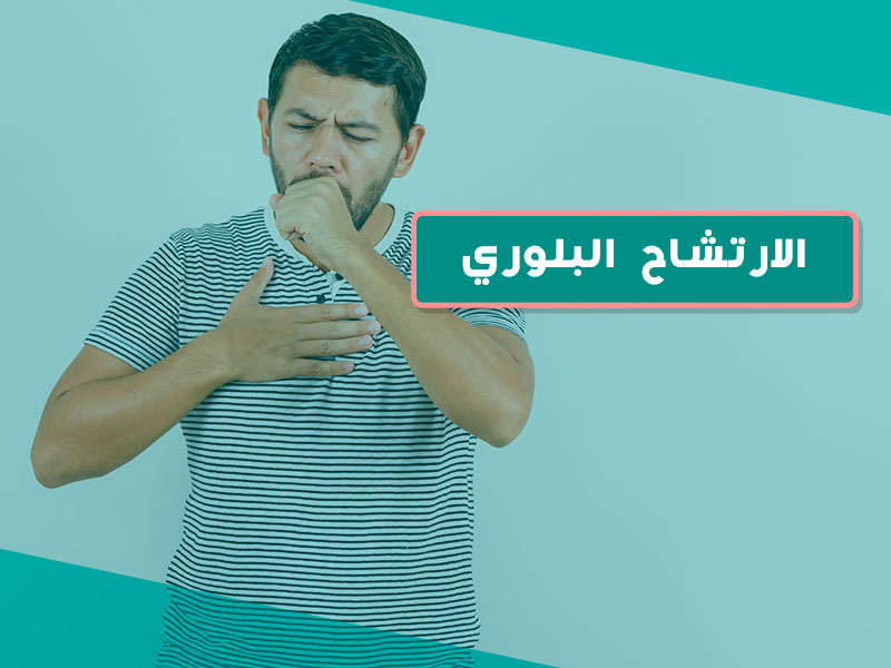 الارتشاح البلوري