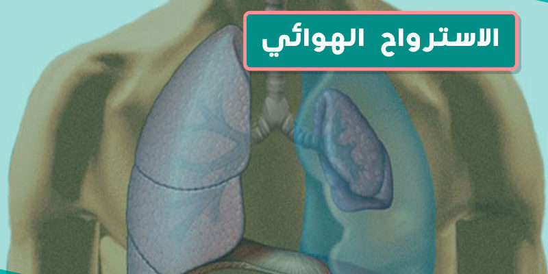 الاسترواح الهوائي