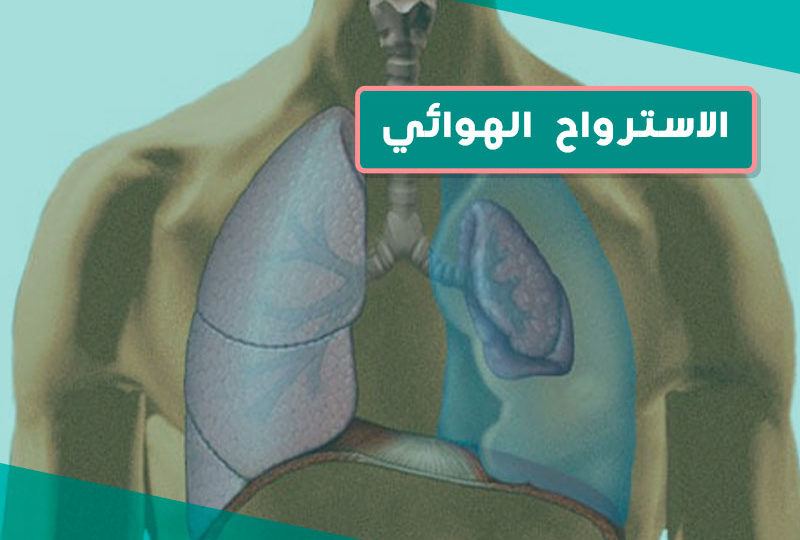 الاسترواح الهوائي