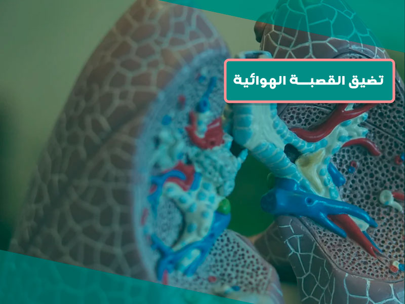 تضيق القصبة الهوائية