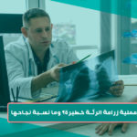 هل عملية زراعة الرئة خطيرة؟
