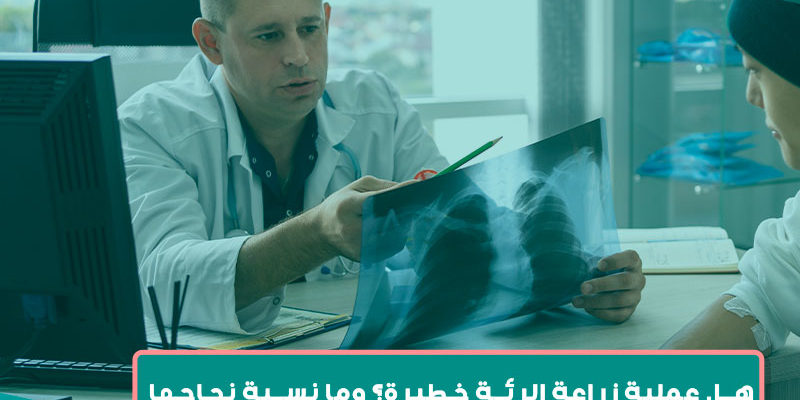 هل عملية زراعة الرئة خطيرة؟